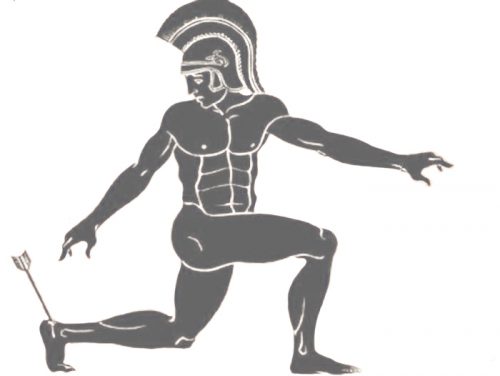 Achilles, strzała, mitologia, ścięgno Achillesa, zatruta strzała, Achilles tendon, calcaneal tendon, poison arrow