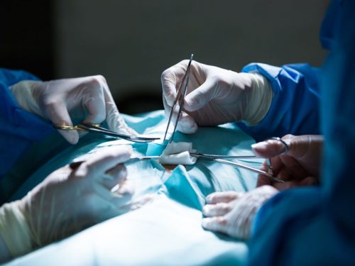 operacja, sala operacyjna, chirurdzy, lekarze, narzędzia chirurgiczne, surgery, surgeons, sutures, chirurgical procedures, operating room, stopa końsko-szpotawa, nie operować