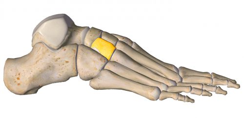 anatomia stopy, szkielet stopy, części stopy, kolory, budowa stopy, structure of the foot, skeleton of foot, foot anatomy, kość klinowata, kość klinowata boczna, lateral cuneiform
