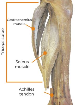 triceps surae, gastrocnemius muscle, soleus muscle, Achilles tendon, calf muscles